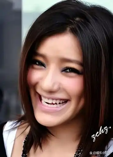 超女冠军江映蓉:却因整容失败像"怪物",全身只有眼珠是自己的