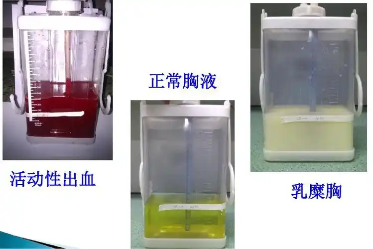 概述引流液红色主要成分是血液,黄色是漏出液或渗出液,乳白色是乳糜漏