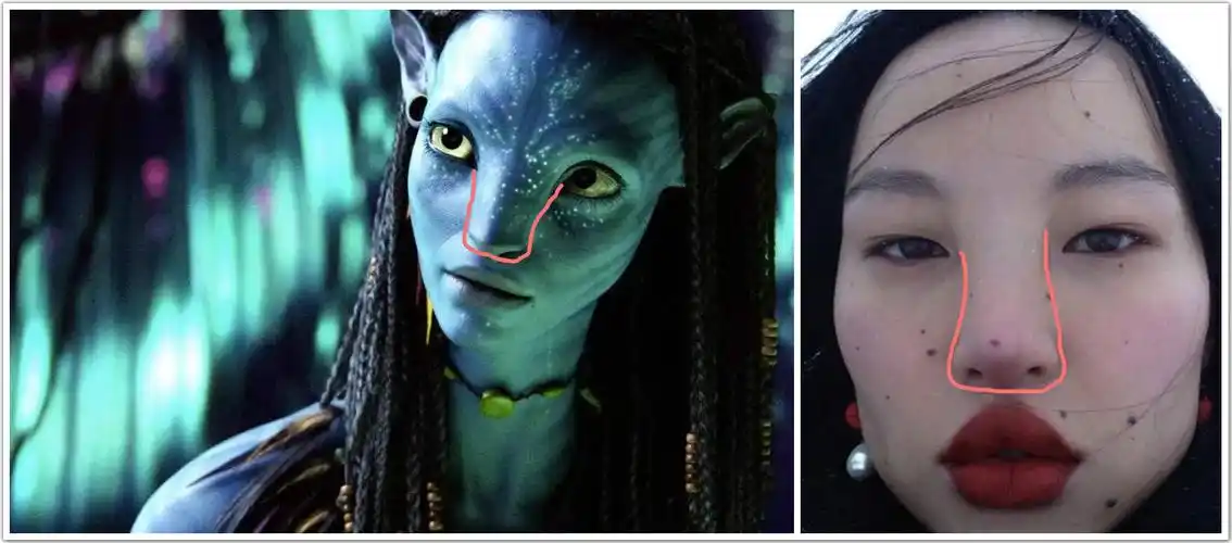 阿凡达式的鼻背宽度,真的是高级脸吗?