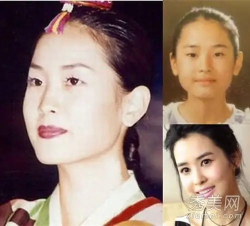 小眼睛,塌鼻子和典型的韩国大饼脸,实在谈不上漂亮,而整容后俏皮惹人