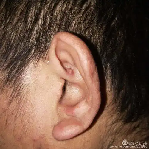 宋士斌耳穴望诊临床图集(2)