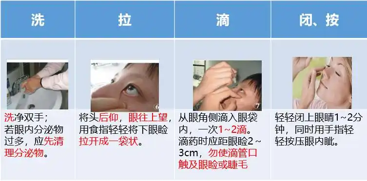 使用眼膏剂后,眨眼数次,使眼膏分布均匀;若同时使用两种滴眼剂,宜间隔