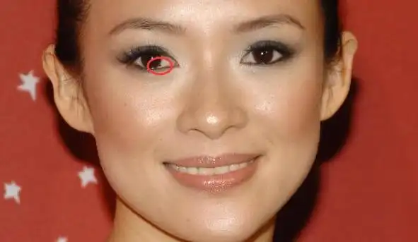 原创 这是章子怡脸上的瑕疵么?右眼里居然有颗痣,网友:孤陋寡闻了