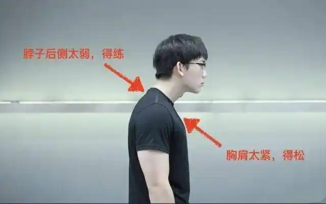 小猿制作脖子前倾毁人无数如何解决提高气质