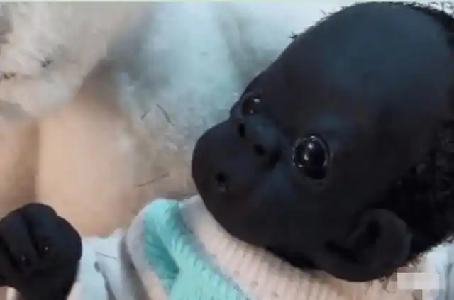 大家还记得"世界最黑的孩子"成什么样了?