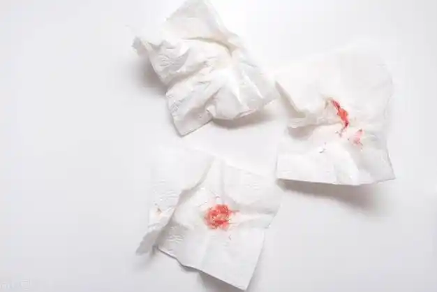 女性同房后"下面"出血是怎么回事?医生:或是宫颈癌信号