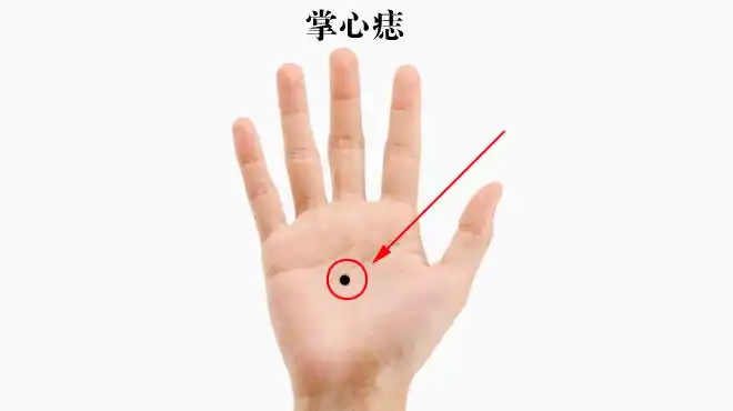 这3个地方长痣最有福气,一生好运不断,衣食无忧