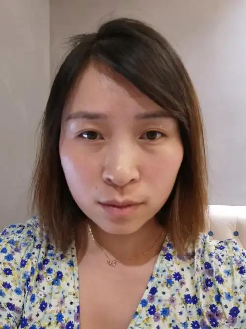 颧骨突出山根低嘴突姐妹看还有救吗01