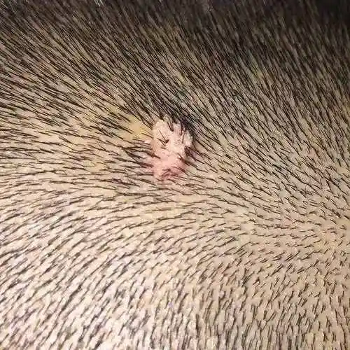 瘊子图片瘊子有传染性