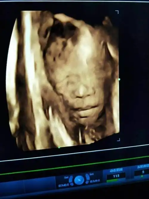 四维顺利通过男宝分享10条怀男孩的症状接男宝如愿了