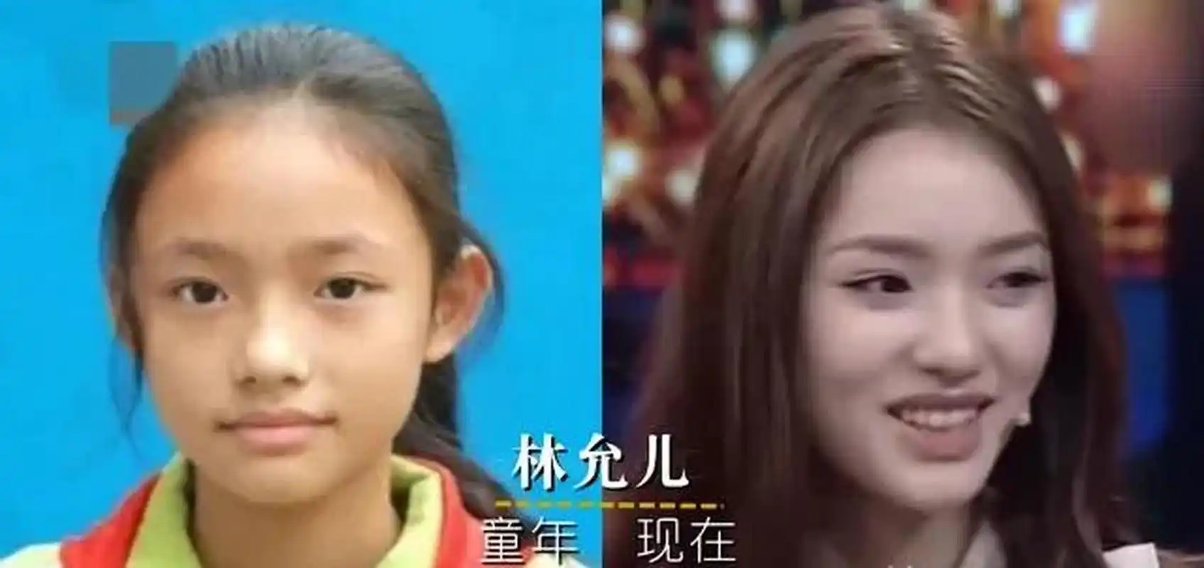 领动计划# 18位明星小时候颜值比拼,林允 周冬雨整容式长大,杨颖杖葺
