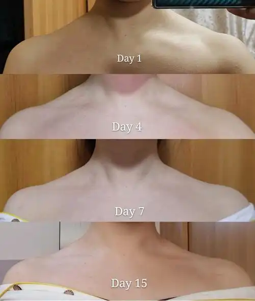 天鹅臂 直角肩 斜方肌拉伸两周对比_天鹅臂_芭蕾_收腹_驼背_长腿