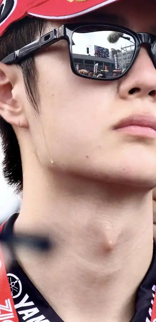 网友:王一博素颜贴脸照皮肤好好~但是好像看到了鼻翼切口