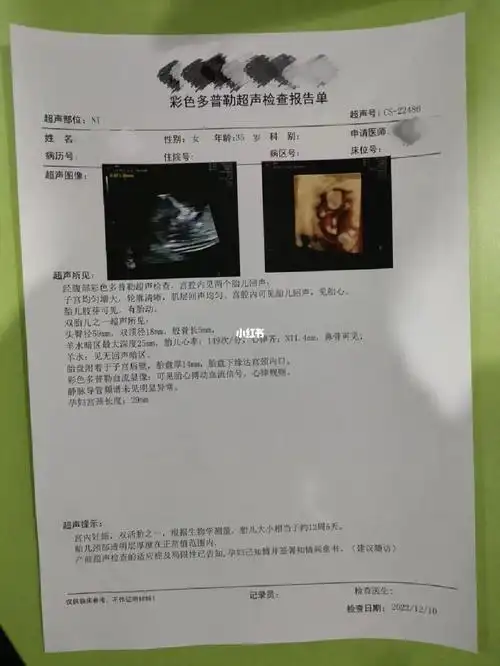 恭喜孕12周的双胞胎宝宝产检一切正常#试管之路  #试管经历  #三代