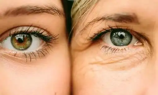 肌肤老化的表现及形态分析,医美治疗选择全解析