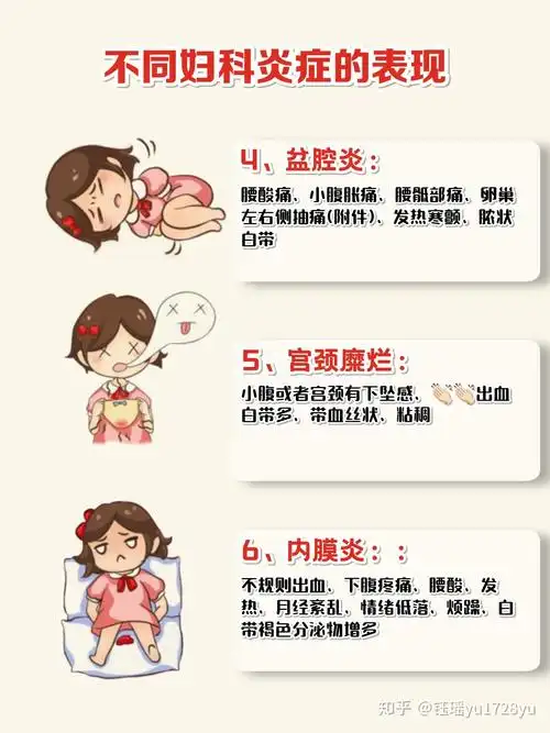 女生常见几种妇科炎症自测60你属于哪种63