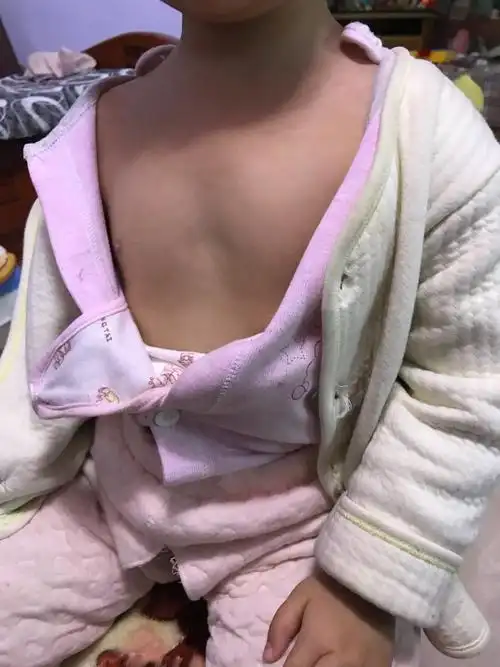 宝妈们这是鸡胸吗?