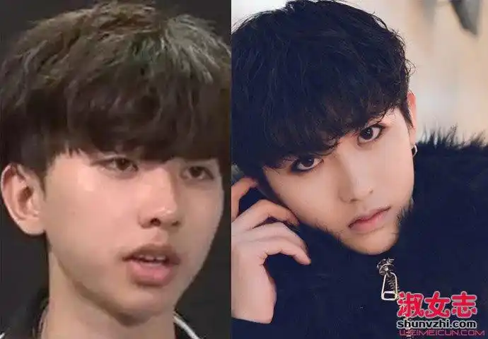 蔡徐坤整容了吗 蔡徐坤被质疑整容了