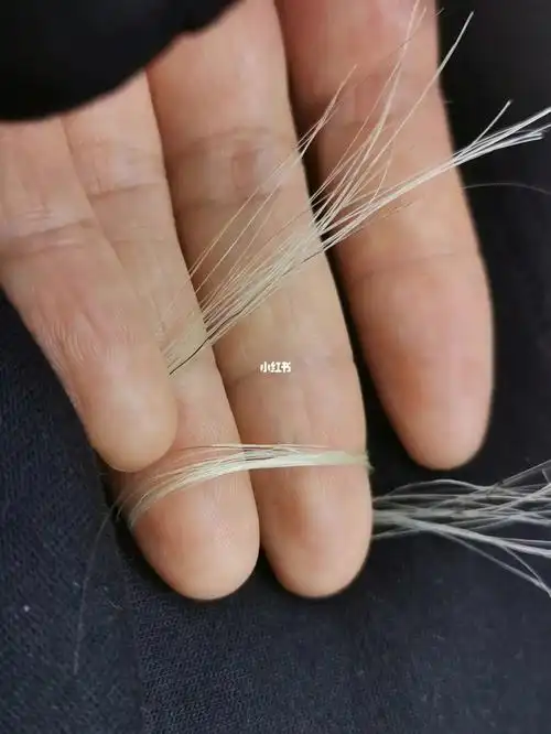 年纪轻轻白头发一大堆剪下来合成一撮