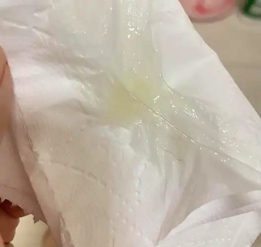 大家帮我看看排卵期这样的白带正常吗(内附照片慎点!