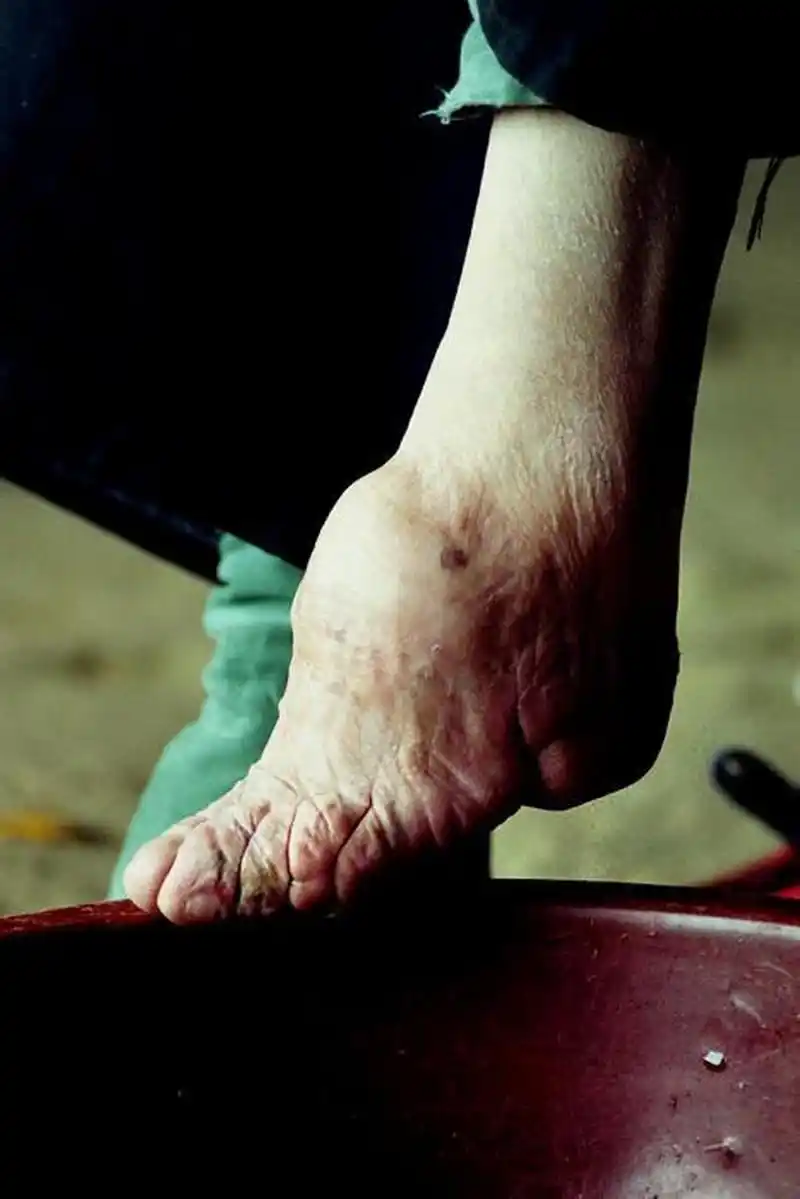 而这一项陋习直到民国才彻