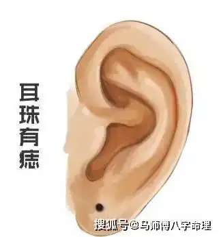 也是组成一张脸重要的组合,耳朵是可以听声音的,耳朵长痣在命相学上有