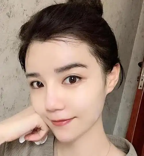 长期敷面膜的人,皮肤有哪些变化?建议经常熬夜长痘痘的女生看看