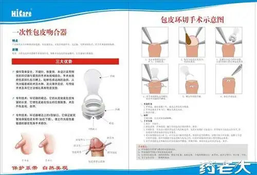 一次性包皮吻合器