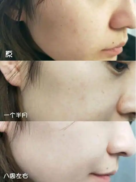 美白祛斑的护肤品哪个品牌好这3款产品效果惊人