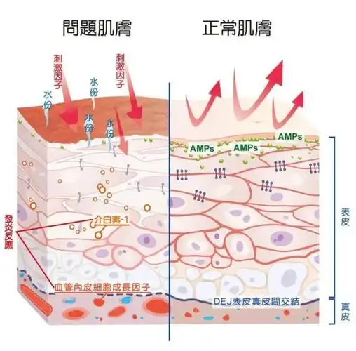 皮肤屏障受损关键:脸上最宝贵的一层膜-皮脂膜!