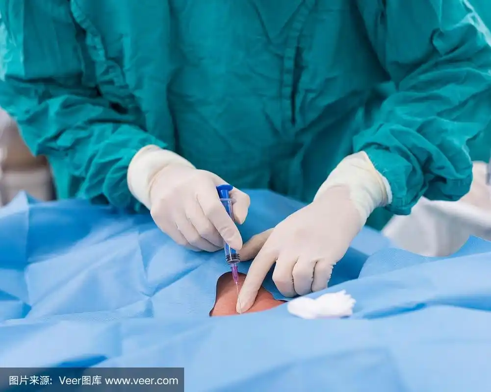 医生穿刺颈内静脉