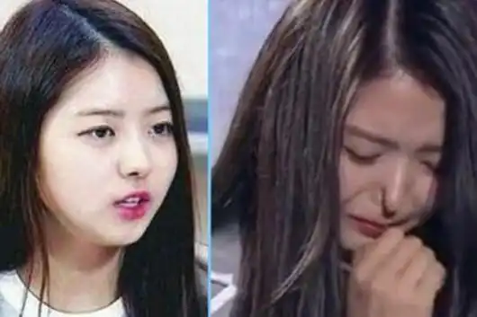 澳门金沙城尊尚住宿礼券-韩国女星鼻子坍塌 网友吓呆任娜英高鼻梁秒变