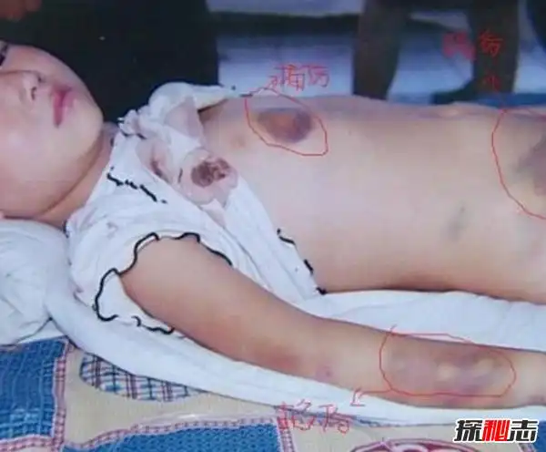 小苏丽事件是真的吗小苏丽验尸照片死后遭亲生母亲扒坟