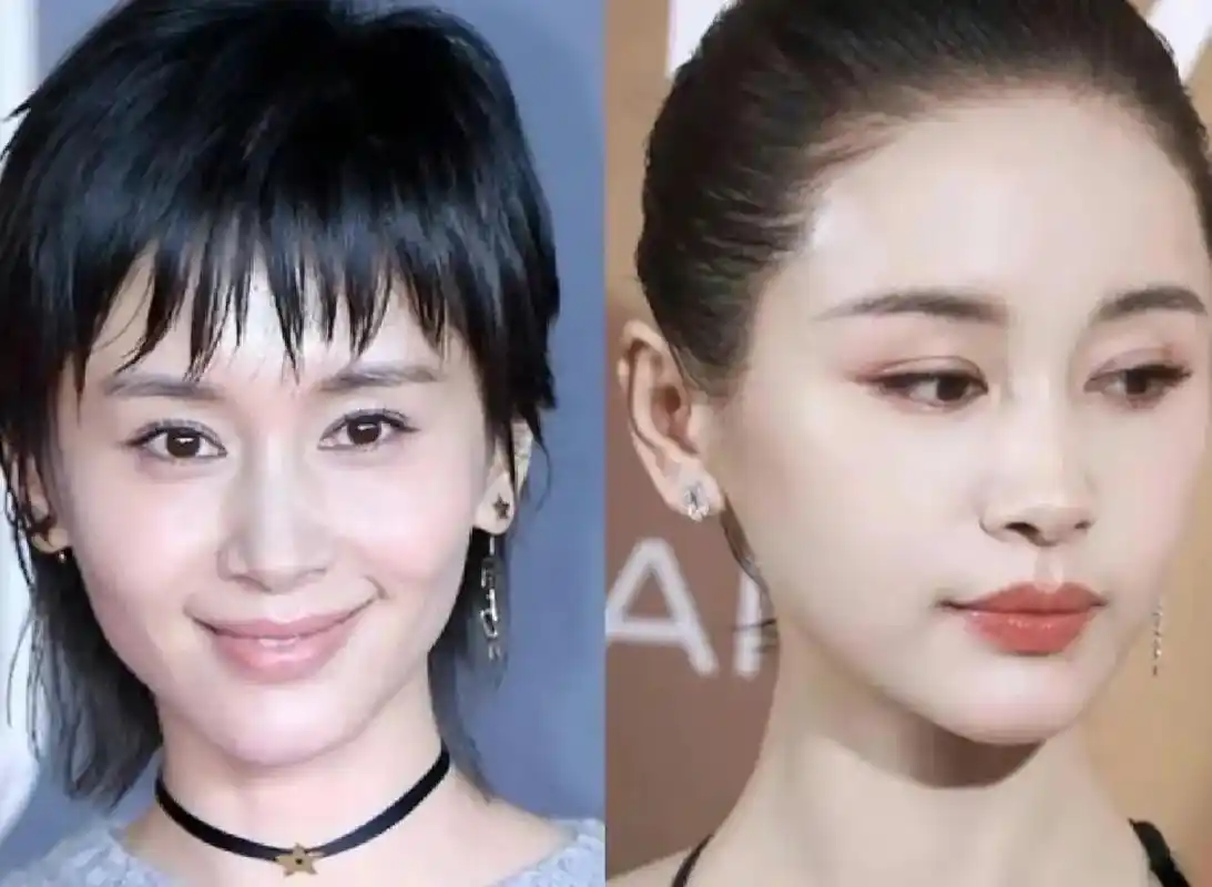 王子文真的很漂亮!我做玻尿酸填充了!真的很减龄!我填充的就 - 抖音