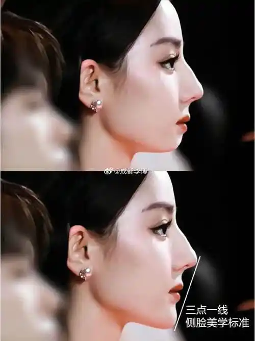 侧脸的颜值 关键在下巴757597很多人都欣赏自己的侧脸,拍照的