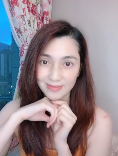 洪欣晒素颜照两个月没做头发很邋遢胳膊的淤青引热议