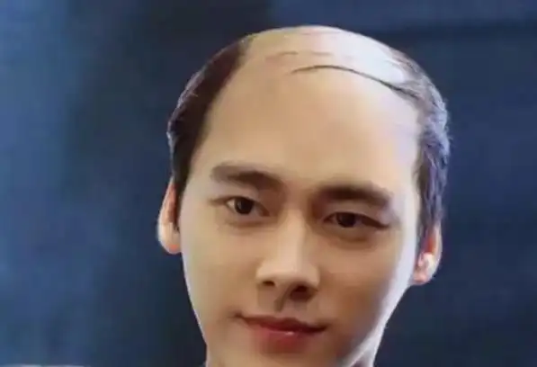 周围钢丝网中间溜冰场秃顶真的好过光头