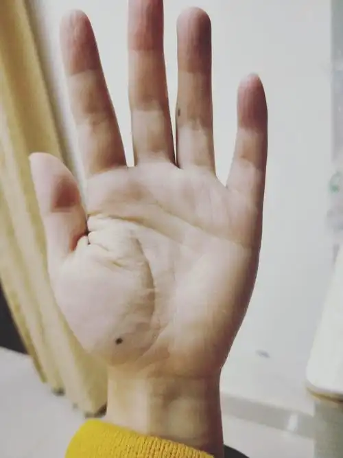我的左手掌心有颗痣突然很想找到右手掌心相同位置也有痣的人