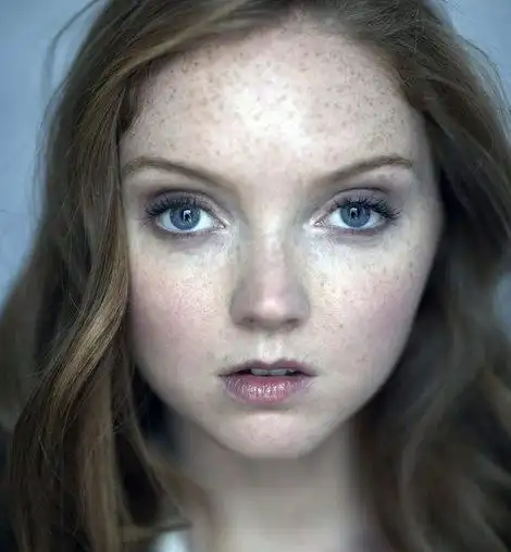 雀斑怎会等如丑化?