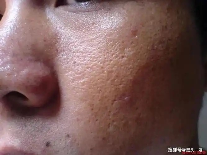 感觉被挡在外面,并 不太吸收~~~ 其实这基本上就是 角质层过厚的原因