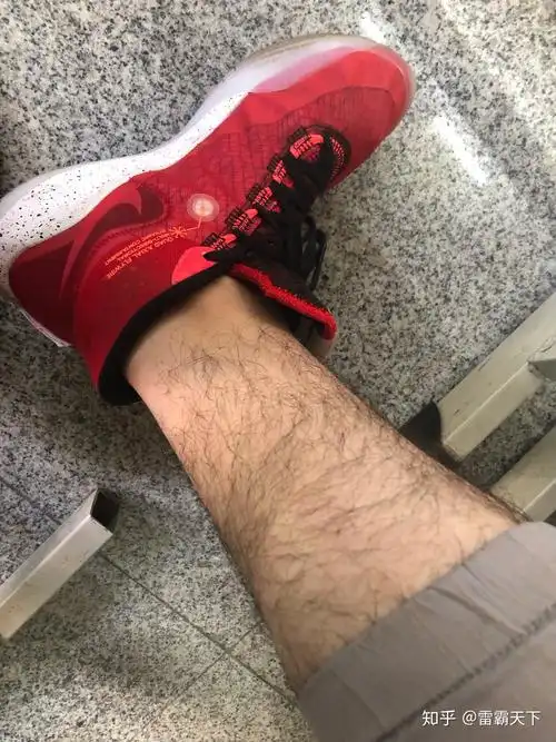 男生的腿毛应该怎么打理?