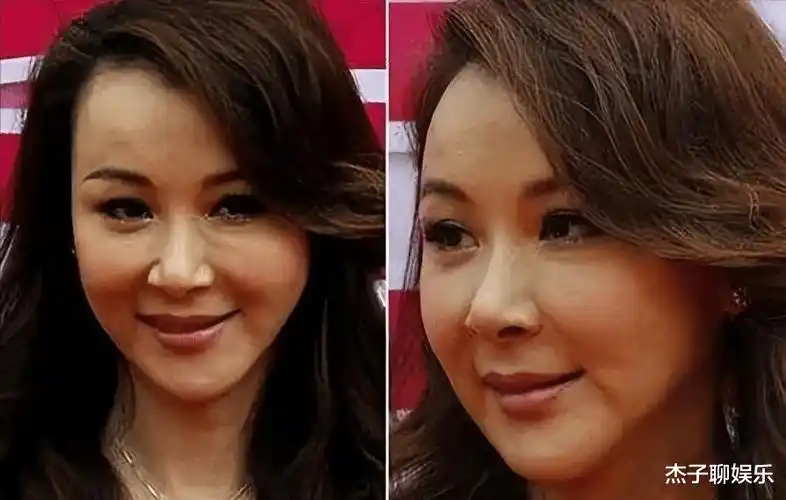 沉迷整容的陈数,后遗症凸显,终于明白自己被医美坑惨了!