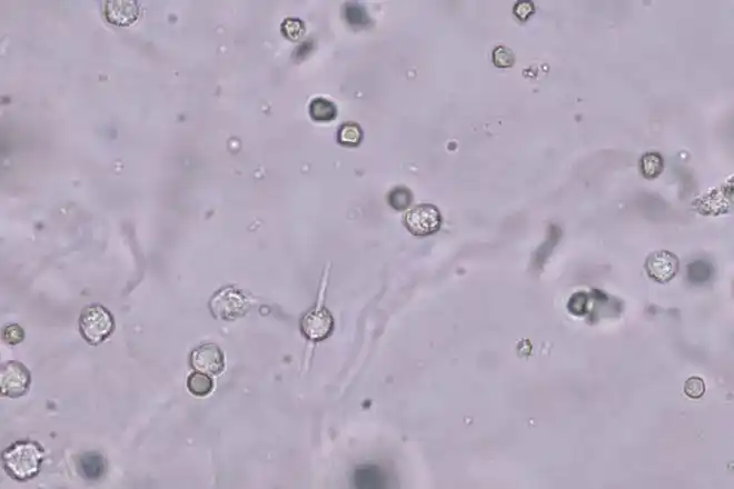 干货美图尿酸结晶千姿百态美到窒息