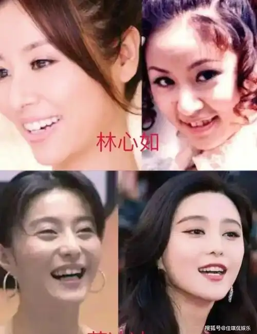 牙齿_明星_观众