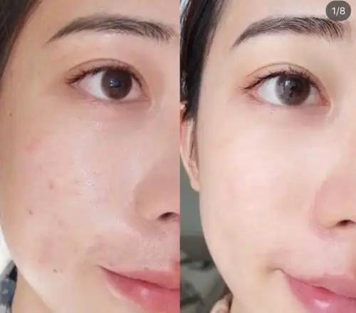 屈臣氏一天卖出7万瓶的"精华液",完爆激光,5天变白嫩光滑