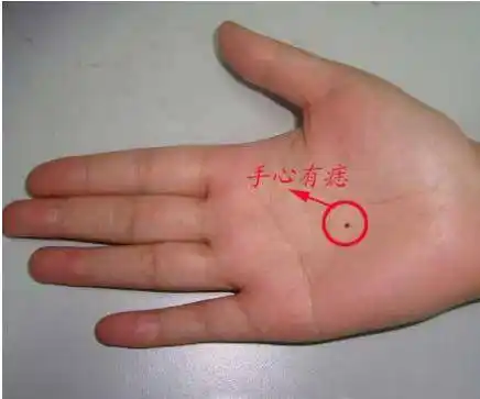 手背下方长痣好不好是大吉大利的兆头手背有痣的女人