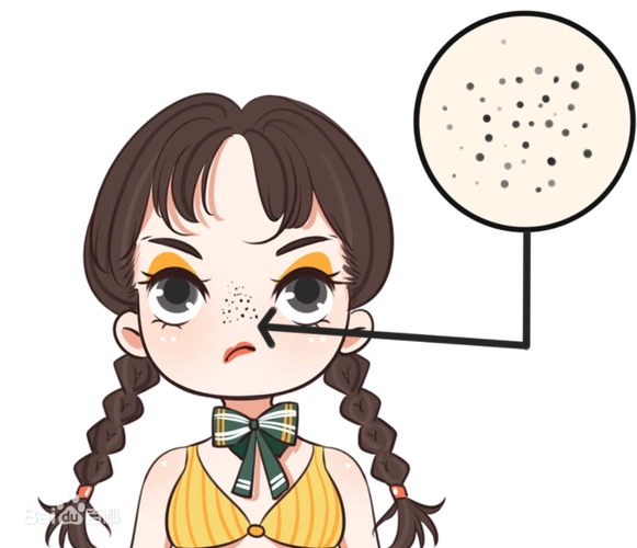 黑头到底怎么解决?一文带你读懂黑头问题!_中华网