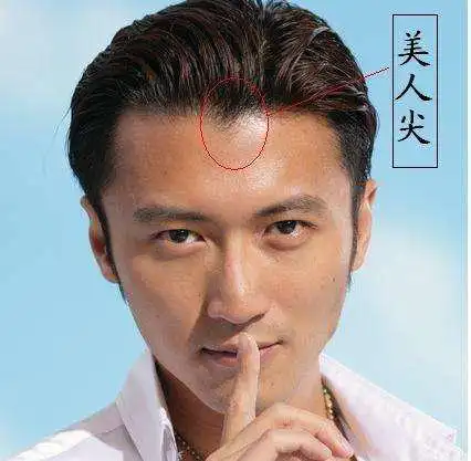 其实人造美人尖不妨考虑毛发移植!