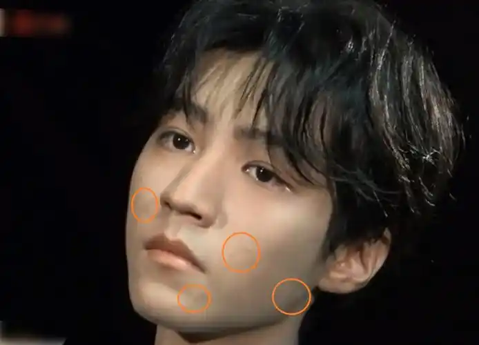 王俊凯脸上有痘痘图片(王俊凯百花奖后台拍摄) - 赤虎壹号