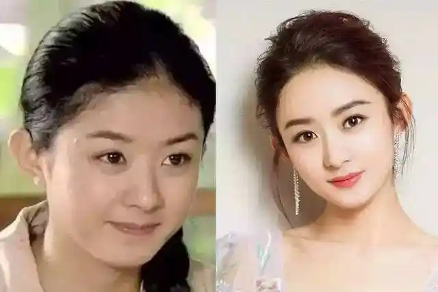 赵丽颖产后脱发?《有翡》《楚乔传》造型对比发际线高低一目了然